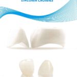ZIRCONIA CROWNS